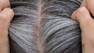 Complexé par vos cheveux gris ? voici 5 méthodes naturelles pour les faire disparaitre !