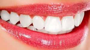 Blanchissement des dents : voici quelques astuces pour rendre vos dents plus blanches !