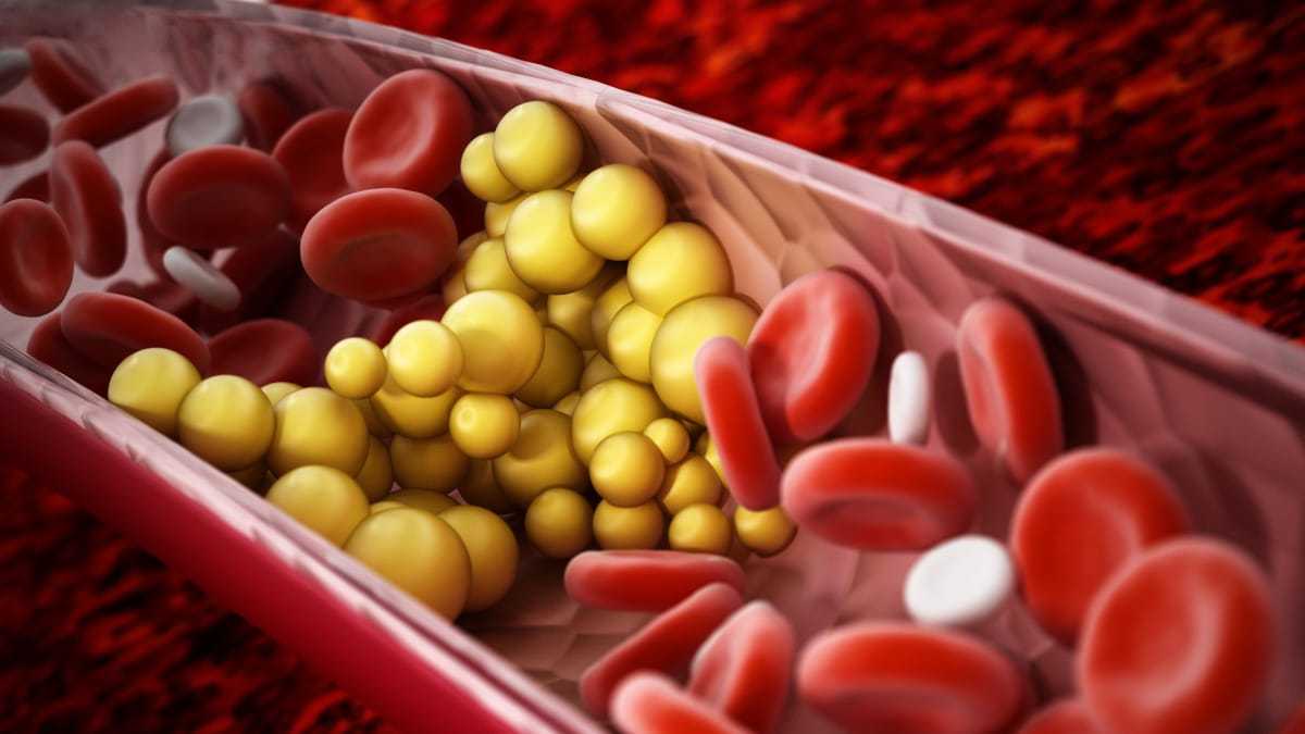 Voici les 5 fruits miracles pour réduire le mauvais cholestérol et déboucher vos artères
