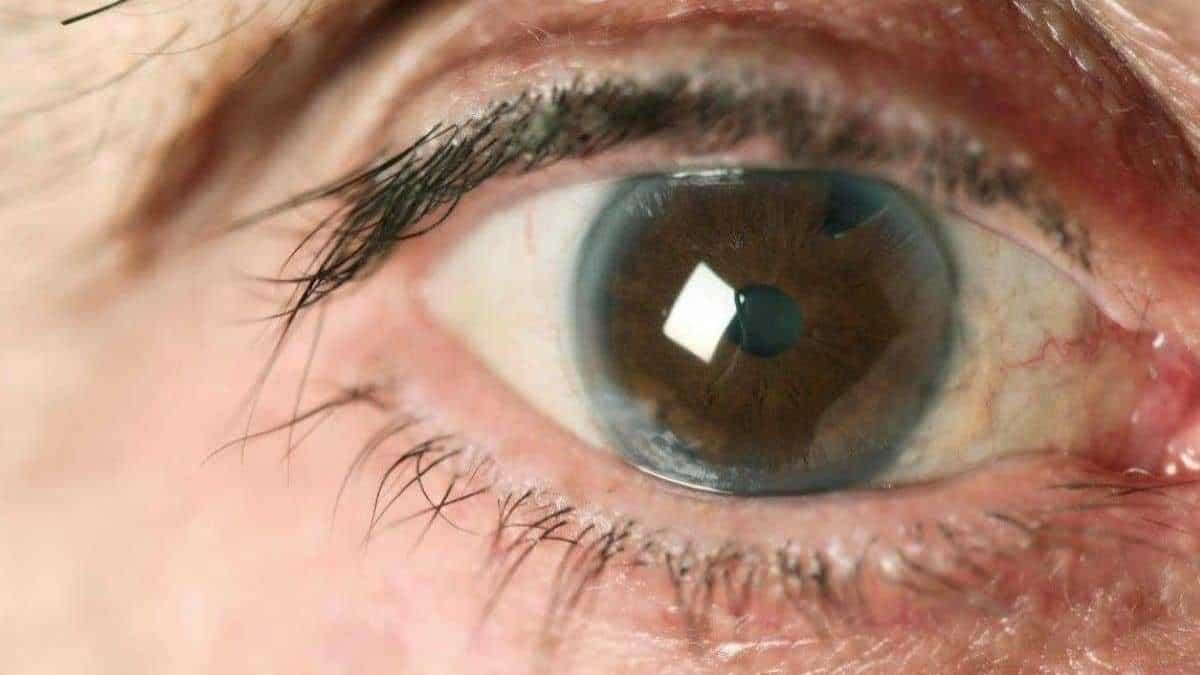 La cataracte peut être bloquée par cette vitamine que nous ingérons tous les jours