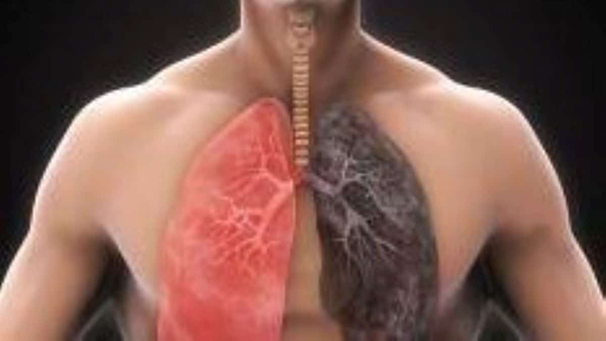 Cancer des poumons : voici pourquoi certains fumeurs ne développent jamais la maladie
