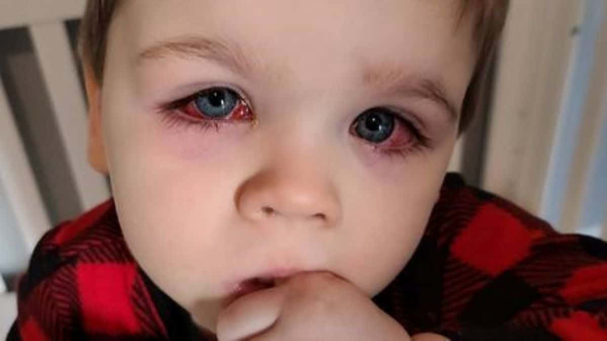 Ce petit garçon perd 75% de sa vue à cause d’un jouet