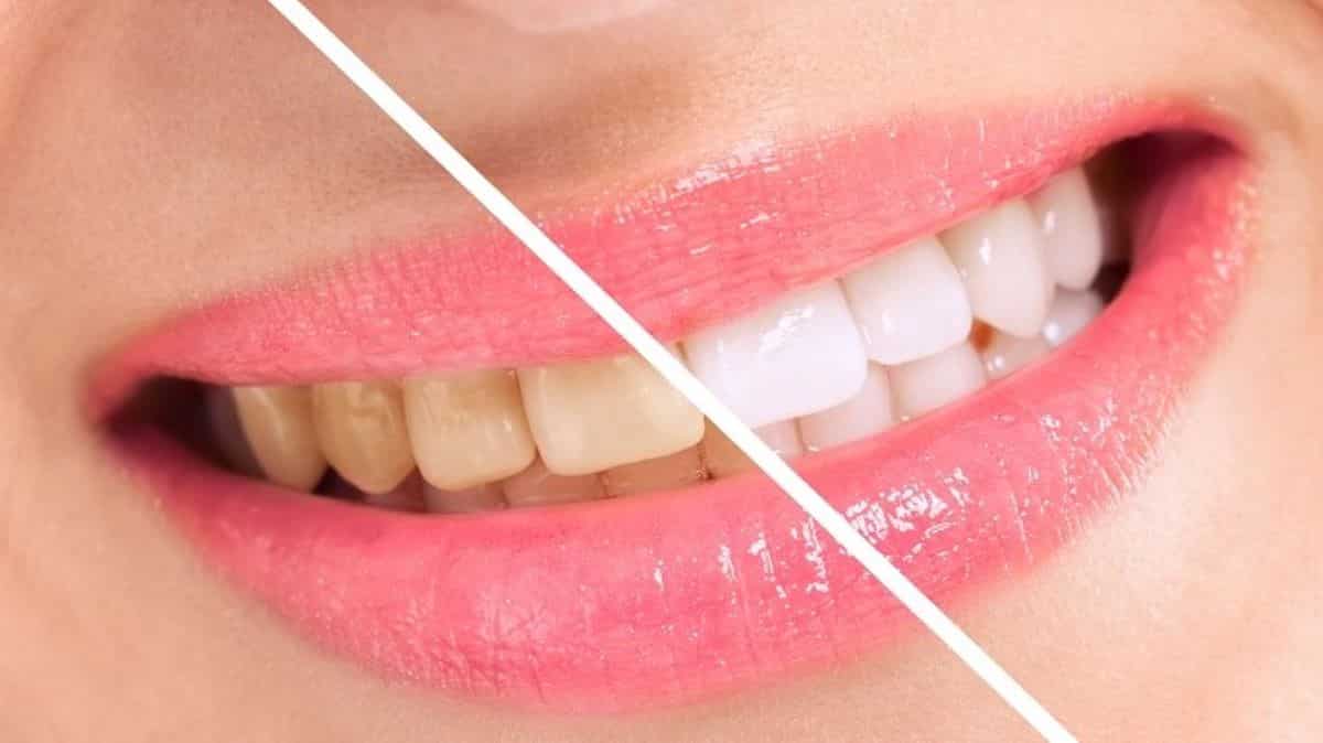 Ce remède ancestral est miraculeux pour blanchir vos dents et supprimer la mauvaise haleine