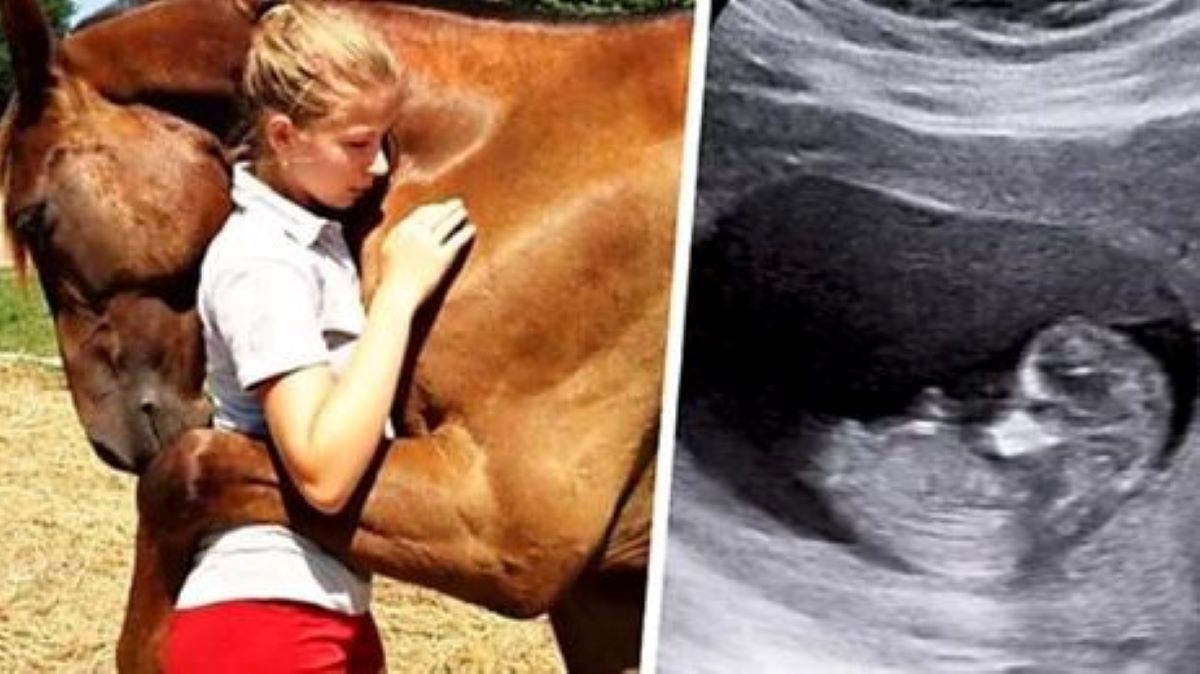 Un cheval étreint une femme enceinte, quand le médecin voit l'échographie, il appelle la police