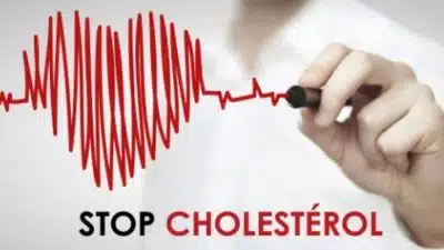 Les meilleurs conseils pour réduire facilement votre taux de cholestérol