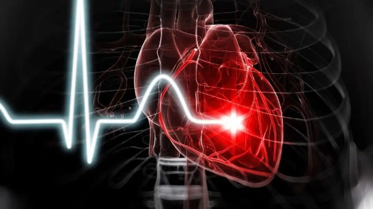 Cardiomyopathie : tout savoir sur les causes, symptômes et l’espérance de vie