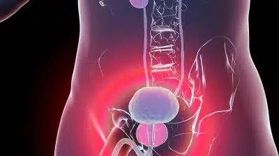 Ces signes évocateurs du cancer de la prostate qui doivent vous alerter rapidement