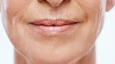 Rides autour des lèvres : ce geste simple à adopter pour les atténuer selon un dermatologue
