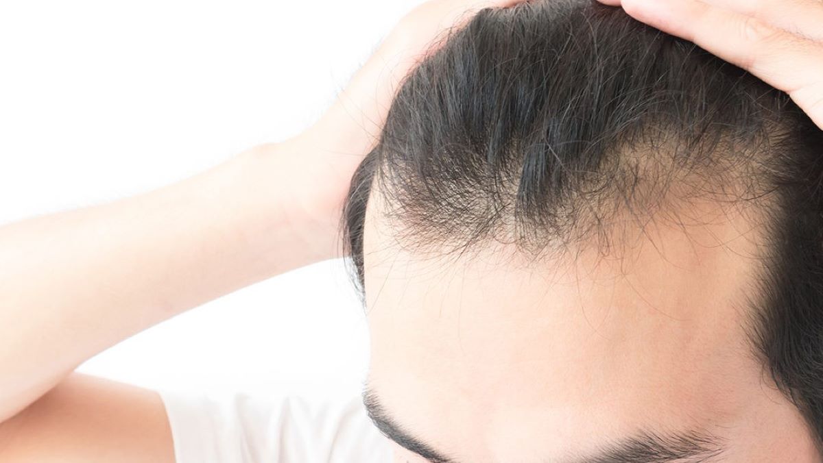 Comment stimuler la repousse de vos cheveux aussi vite que possible : 5 méthodes naturelles
