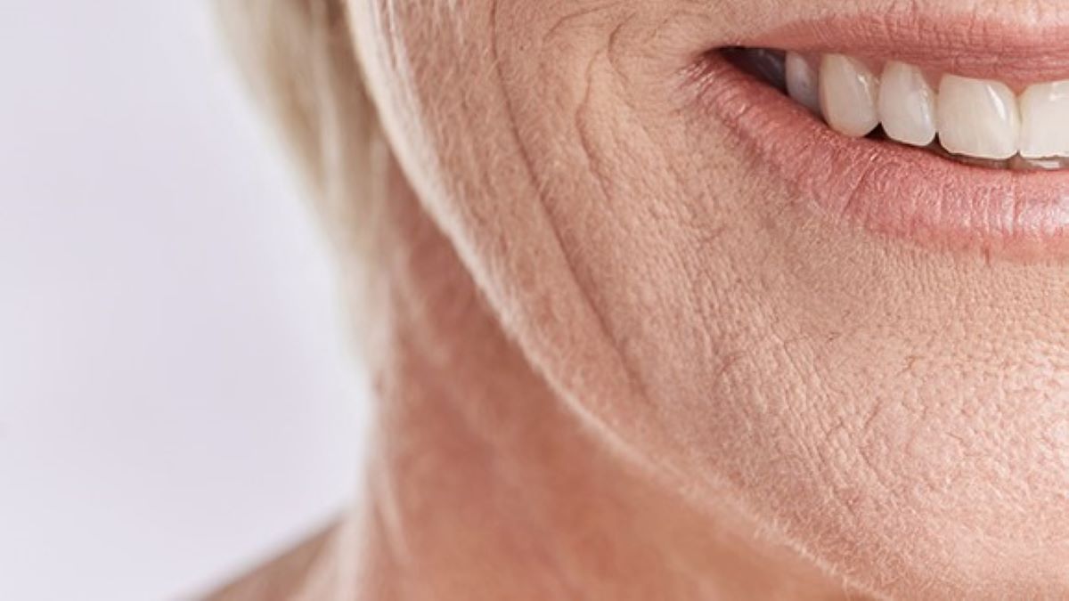 Poils sur les joues : comment s'en débarrasser à la ménopause ?